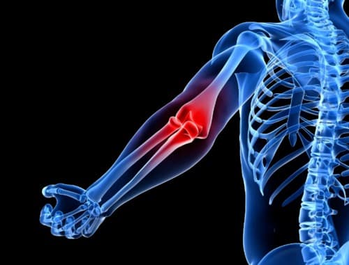 Hondrox resultados reais